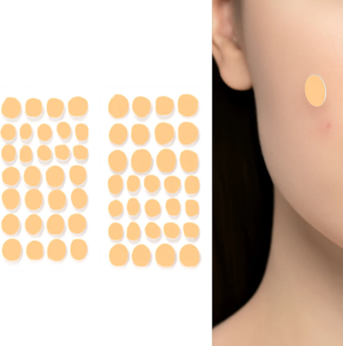 Pimple Patches – Hydrocolloid & Tea Tree Oil for Acne | GlowForm