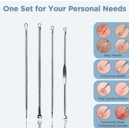 Blackhead Remover Tool – 4-in-1 Stainless Steel Extractor | ToolMate Pro - Image 3