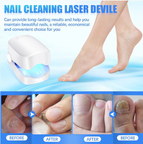 Nail Fungus Laser Treatment – Rechargeable Device for Hands & Feet | AuriGlam