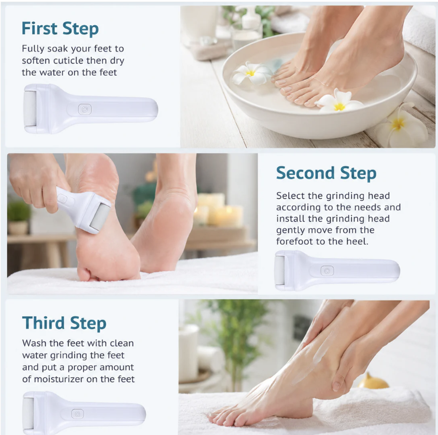 Electric Foot File – Rechargeable Callus Remover | AuriGlam